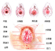 处女膜破裂还能修复么