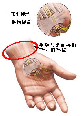 腱鞘炎治疗哪家医院好